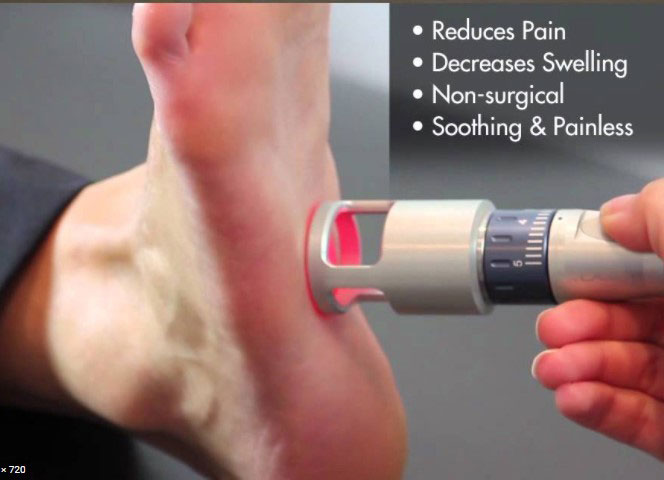 Neurotherapy foot laser